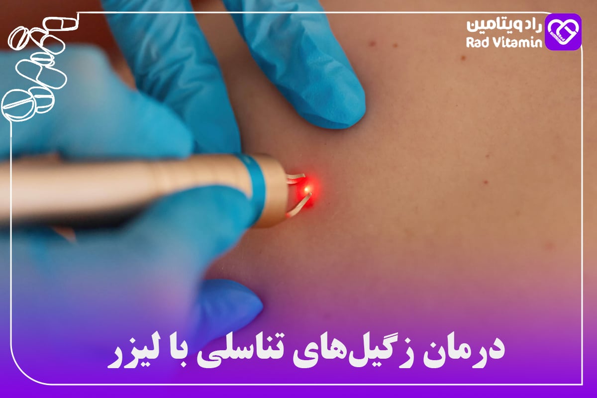 درمان زگیلهای تناسلی با لیزر