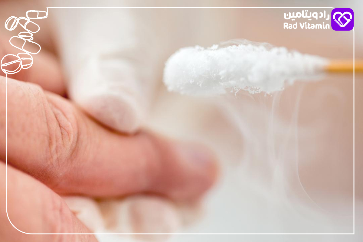 استفاده از اسید سالیسیلیک در زگیل تناسلی