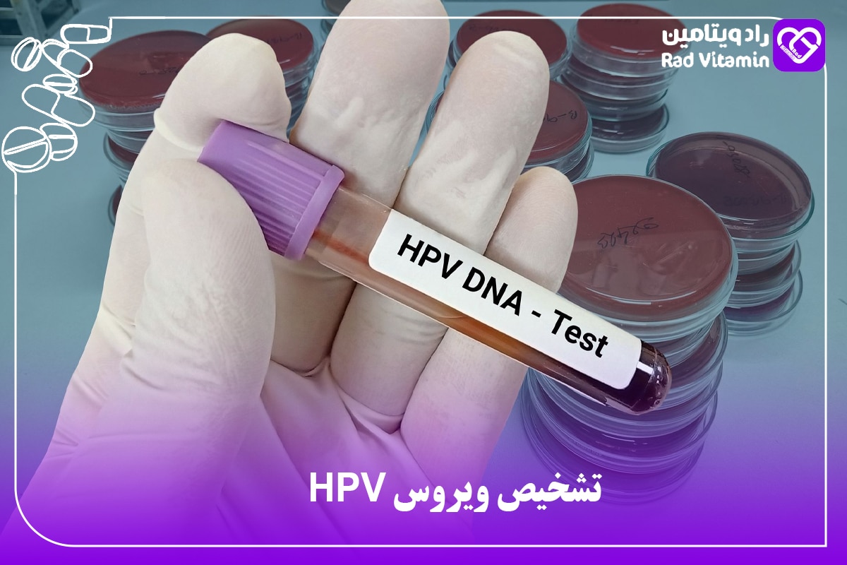 آزمایش HPV DNA