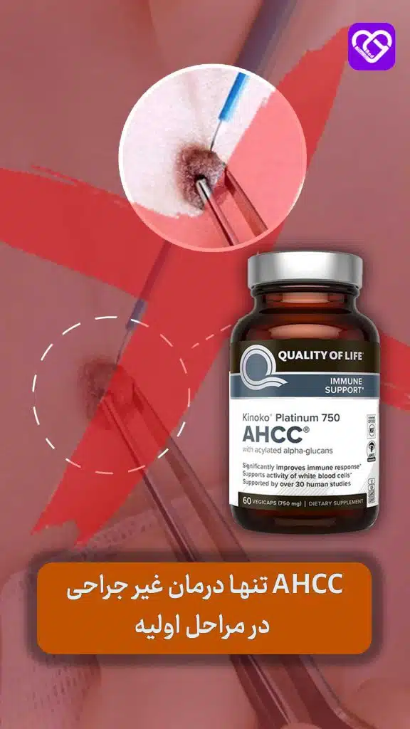 Ahcc تنها درمان غیر جراحی HPV در مراحل اولیه