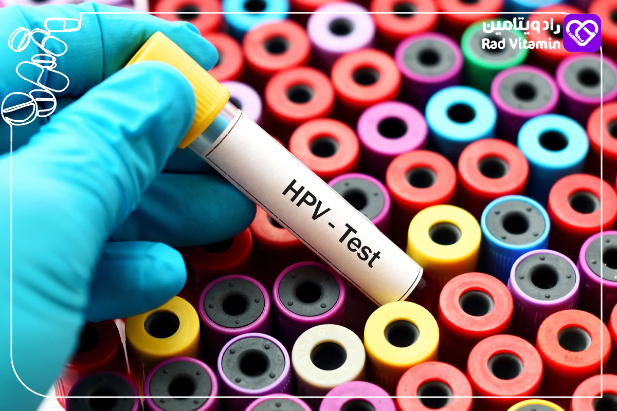 آزمایش‌های تشخیصی برای شناسایی HPV 