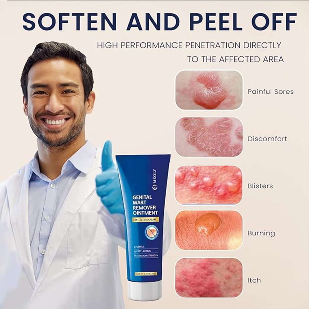 اسید سالیسیلیک برای زگیل تناسلی