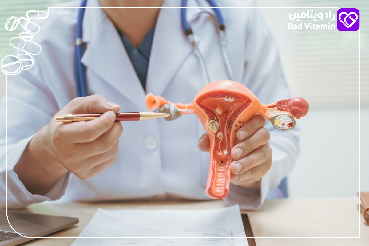  بهبود کیست‌های تخمدان