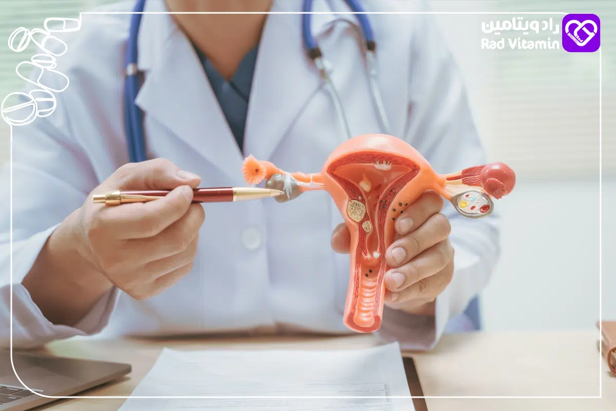 بهبود کیستهای تخمدان