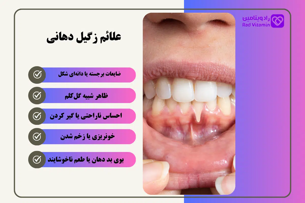 زگیل دهانی چیست؟ (4 روش درمان زگیل دهانی) 2 علائم زگیل دهانی