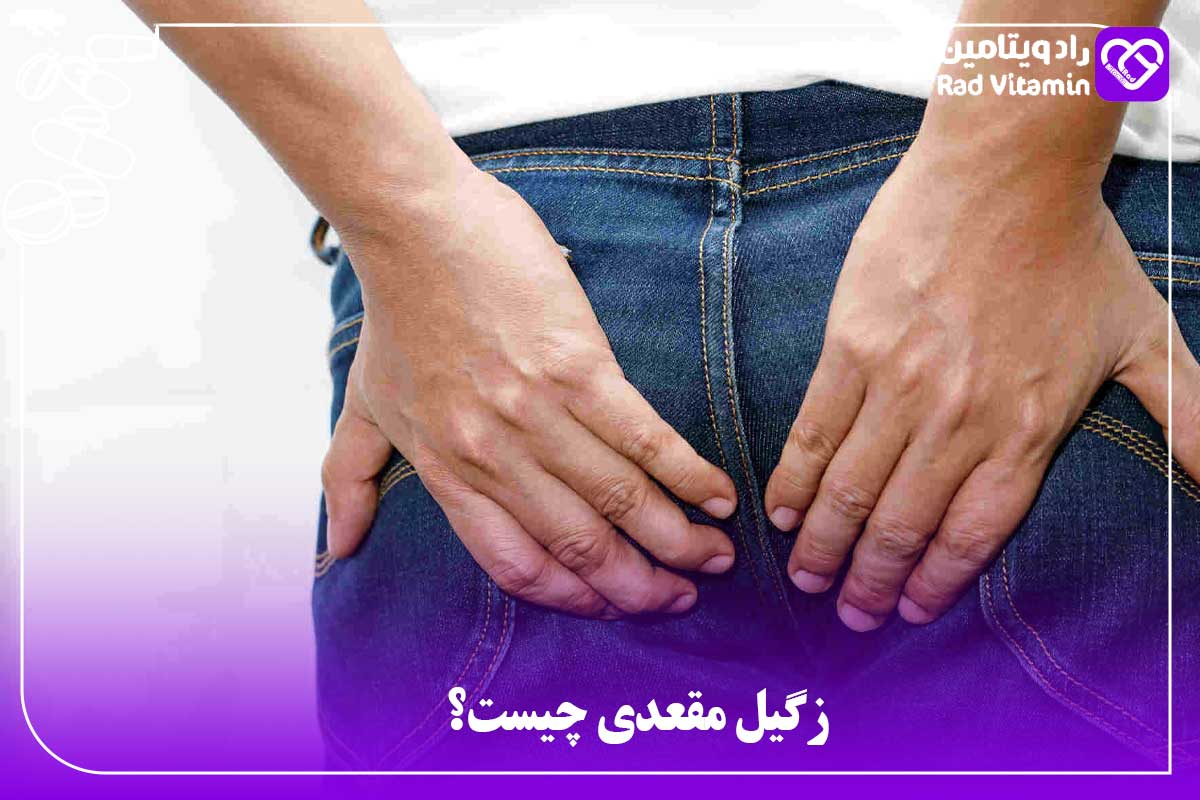 زگیل مقعدی