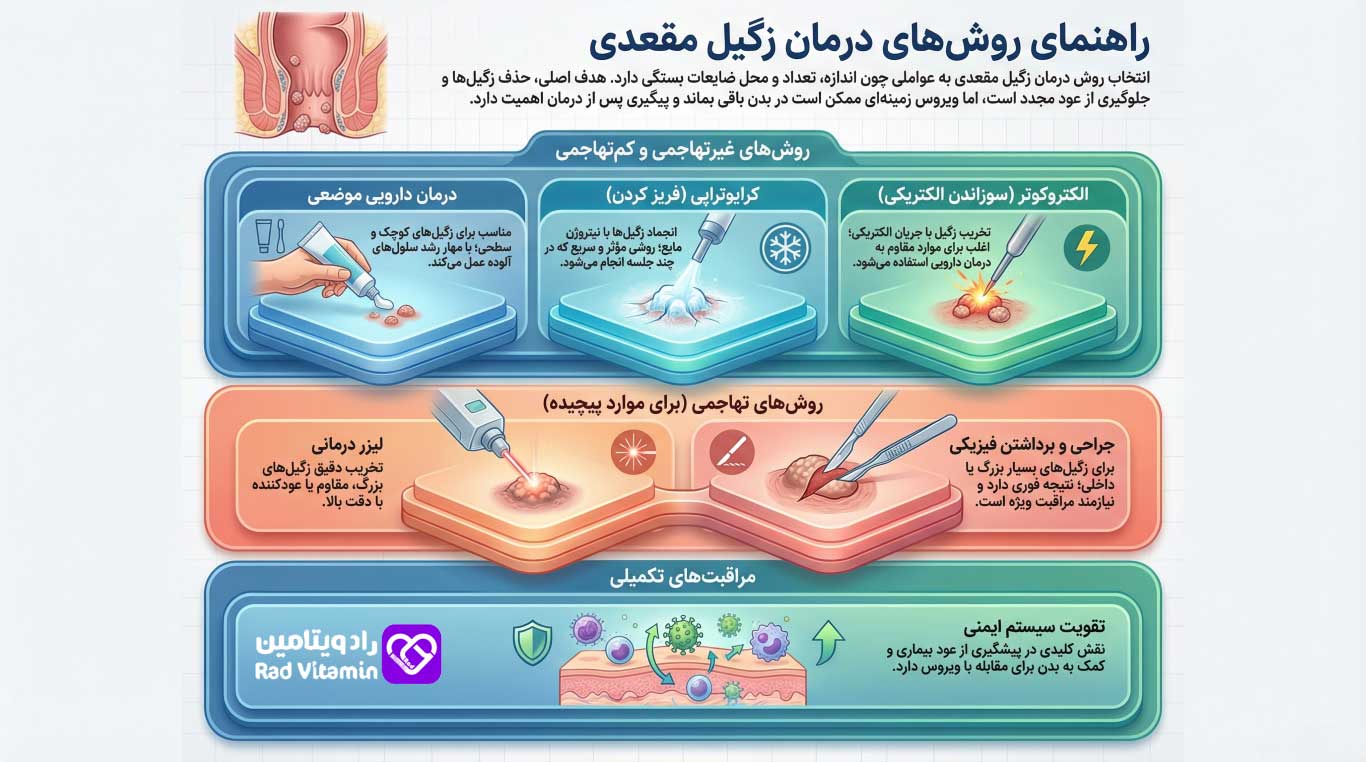 روش های درمان زگیل مقعدی