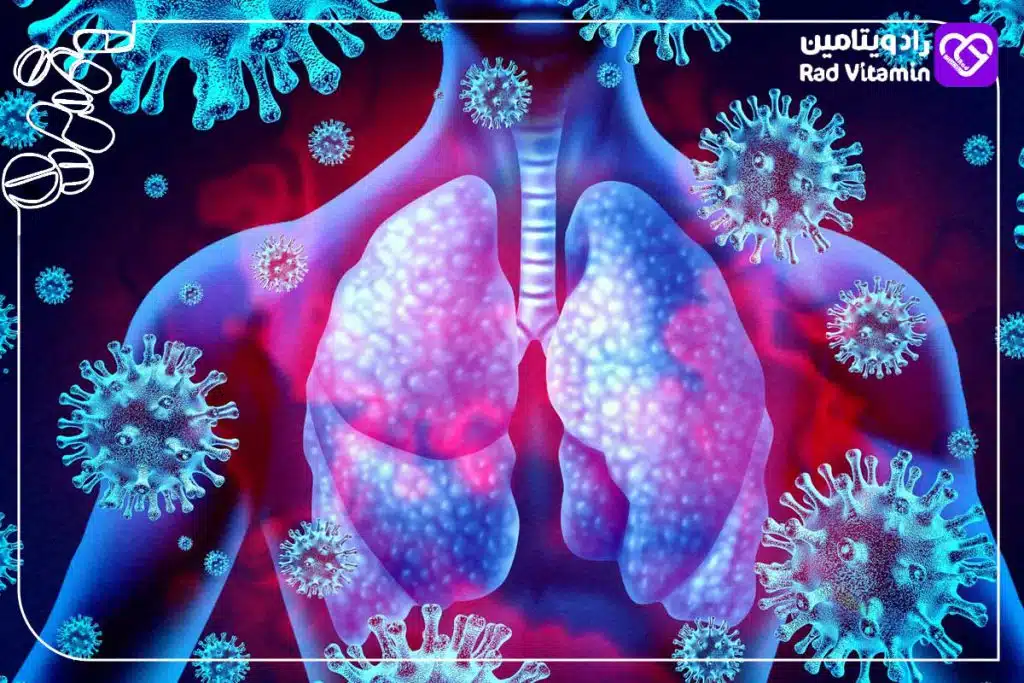 سیستم ایمنی ضعیفی